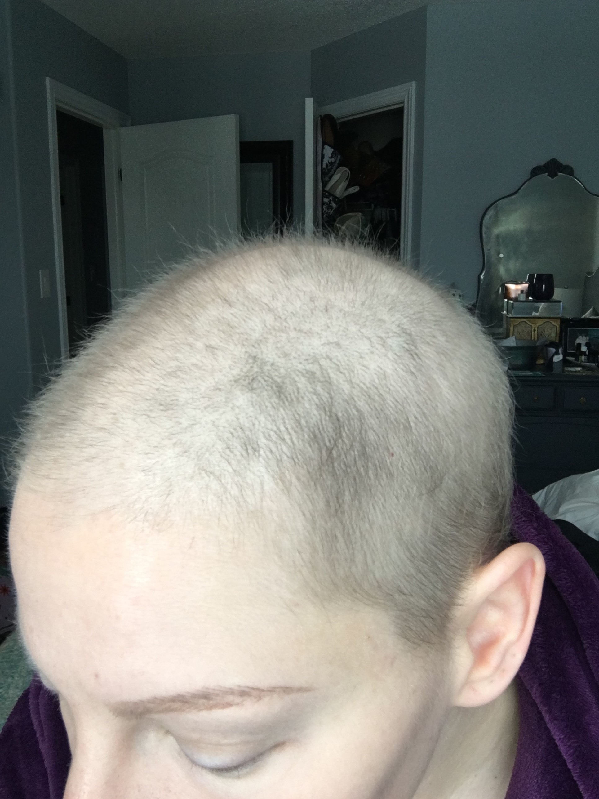 My Tips For Hair Growth Post-Chemo - Rethink Breast Cancer