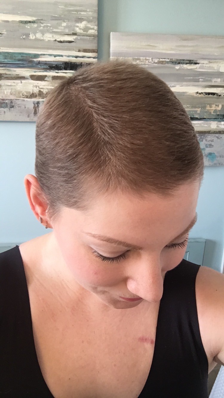 hair growth three months after chemo