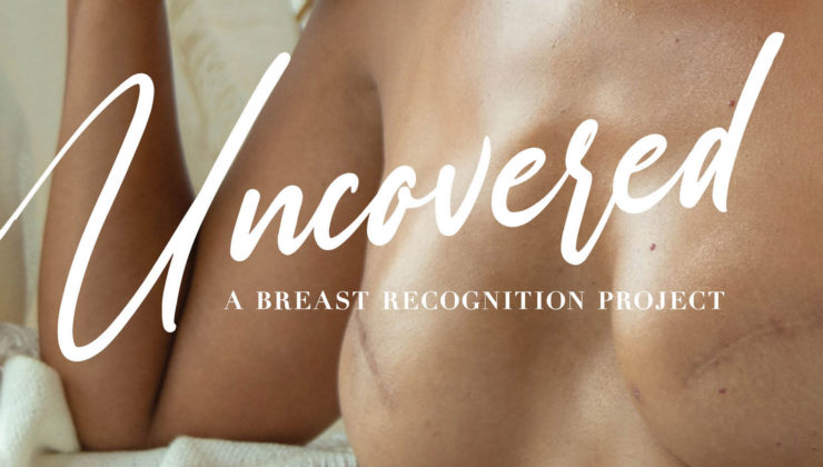 breast recognition project