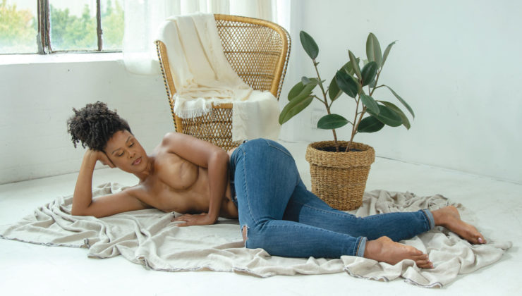 Michelle lying down showing scars after mastectomy and breast reconstruction